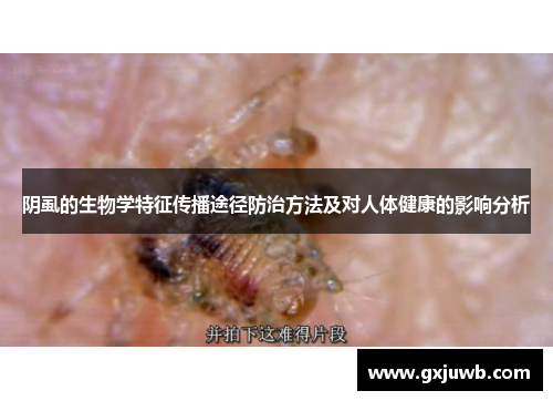 阴虱的生物学特征传播途径防治方法及对人体健康的影响分析